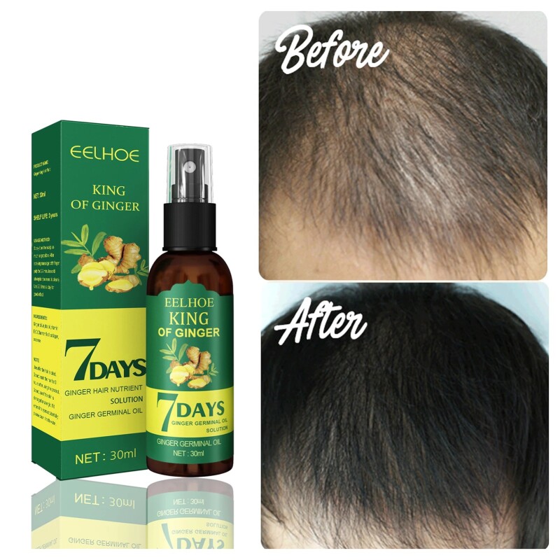 Ginger Hair Growth Serum Sprayer Hair Regrowth s Growth Hair Sprayer For Hair Loss s For Men Women 30ml