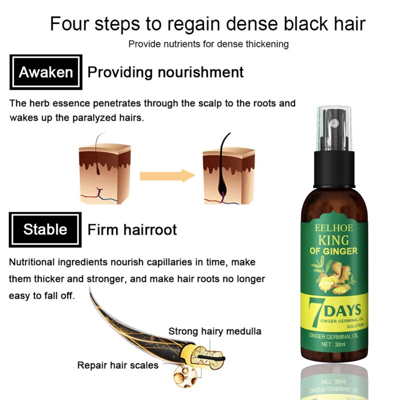 Ginger Hair Growth Serum Sprayer Hair Regrowth s Growth Hair Sprayer For Hair Loss s For Men Women 30ml
