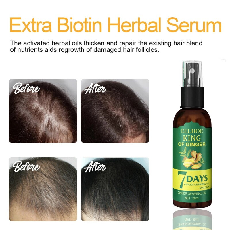 Ginger Hair Growth Serum Sprayer Hair Regrowth s Growth Hair Sprayer For Hair Loss s For Men Women 30ml